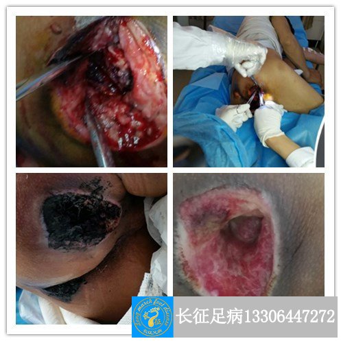 1514018109484549.jpg 1514018109484549.jpg