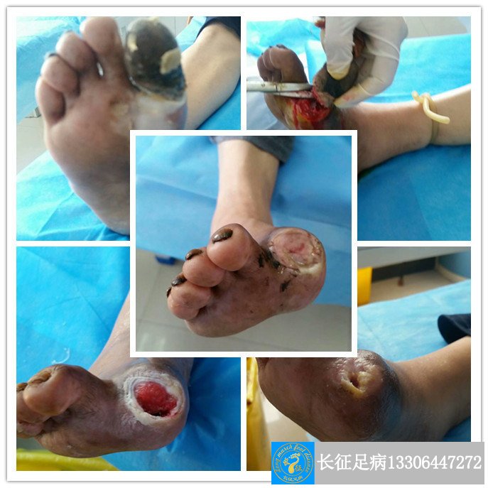 1514872555287829.jpg 1514872555287829.jpg