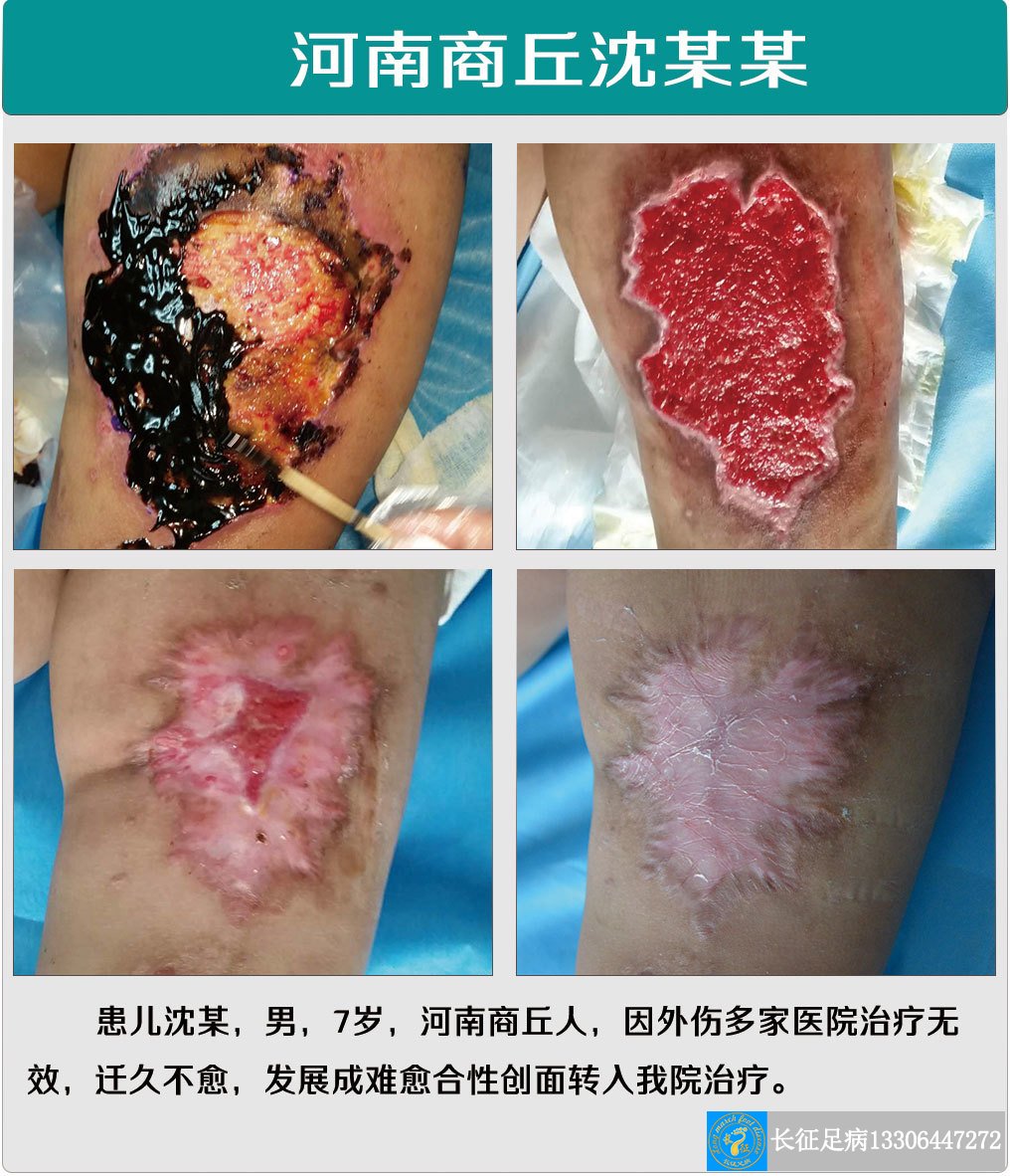 1514449255666500.jpg 1514449255666500.jpg