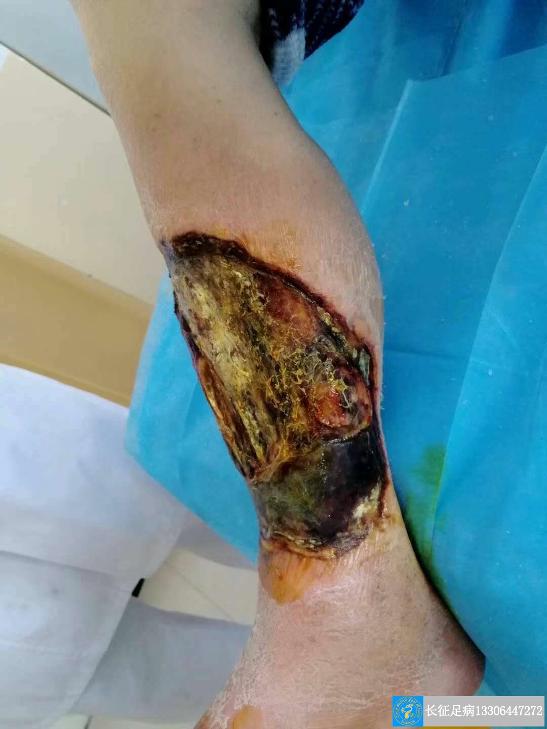 1515480840492625.jpg 1515480840492625.jpg