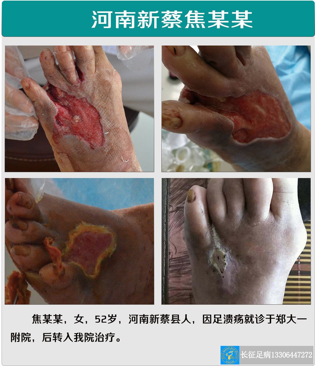 1516605851337871.jpg 1516605851337871.jpg