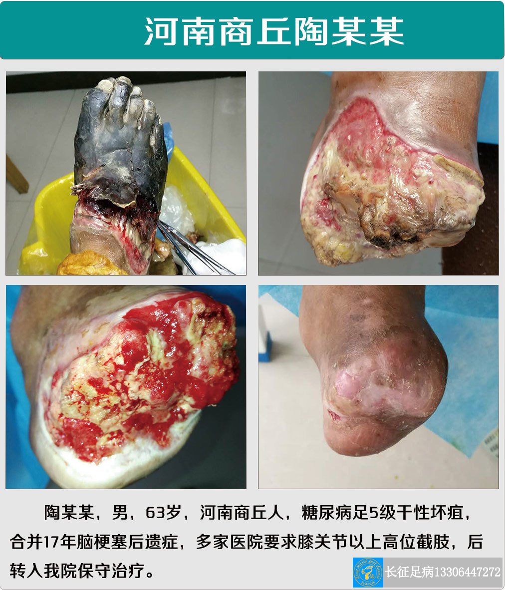 1517992186923788.jpg 1517992186923788.jpg