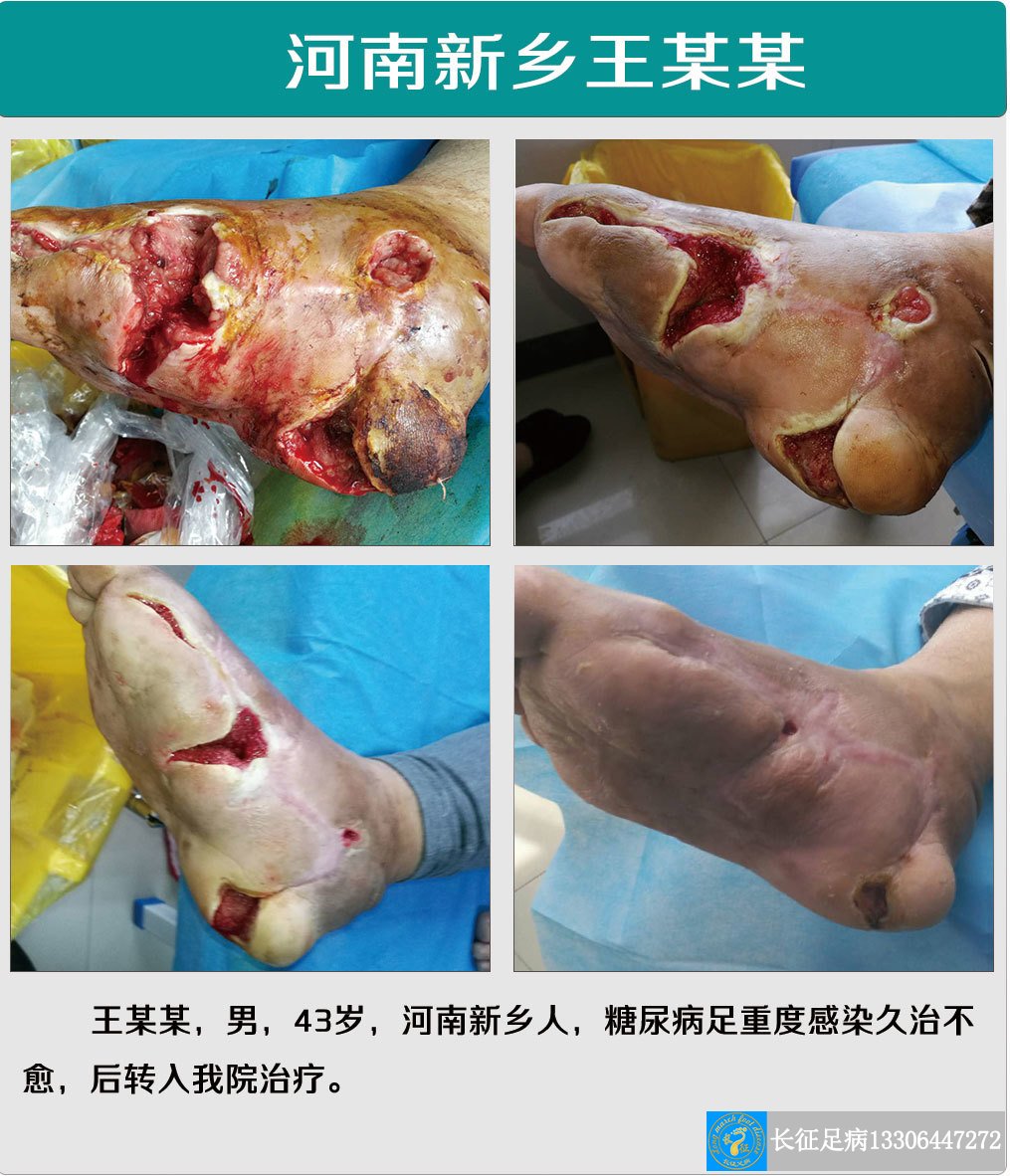 1519806746407976.jpg 1519806746407976.jpg