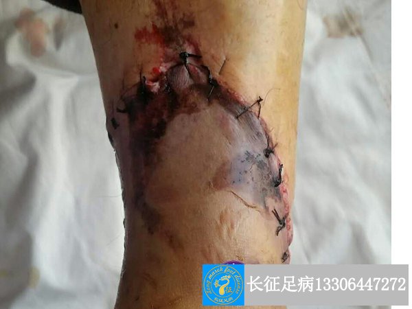 1521010207433182.jpg 1521010207433182.jpg