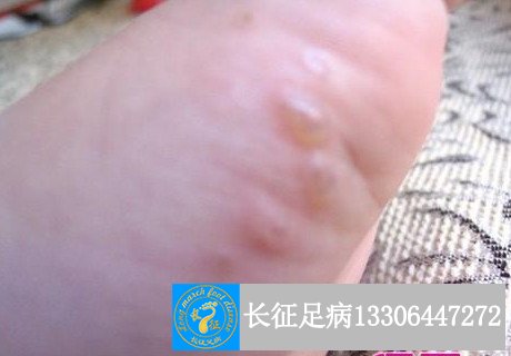 1523848729592193.jpg 1523848729592193.jpg