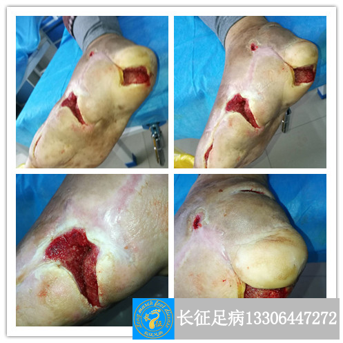 1524299690279028.png 1524299690279028.png