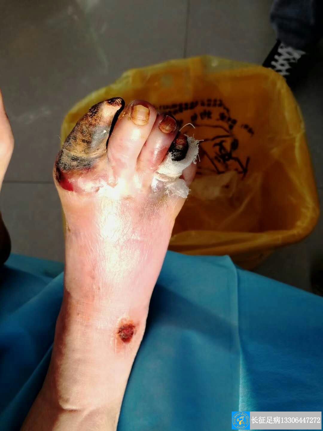 1523175014686996.jpg 1523175014686996.jpg