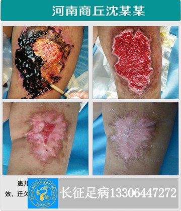 1525857930300649.jpg 自治不愈合_副本.jpg