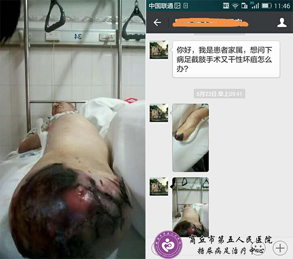 长征足病网