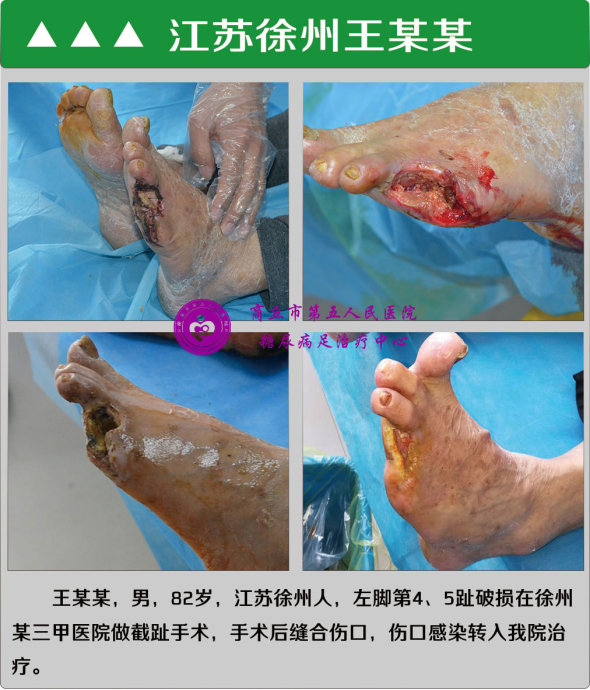 长征足病网