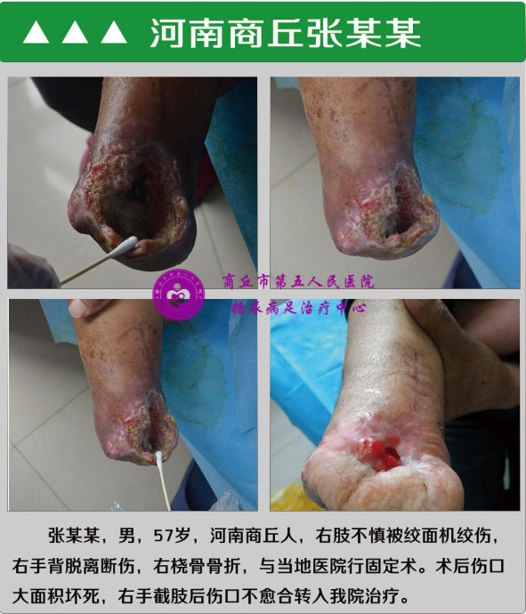 长征足病网
