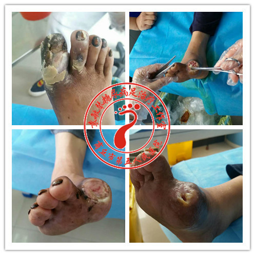 长征足病网