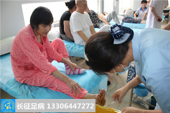 糖尿病足怎么治疗