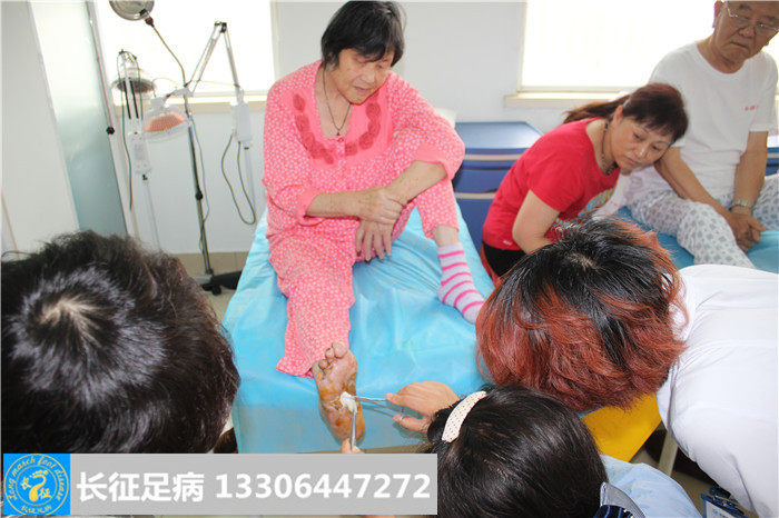 糖尿病足怎么治疗