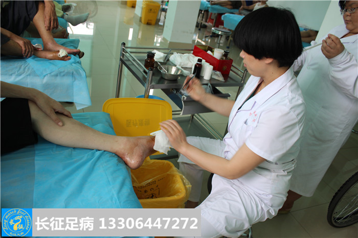 糖尿病足怎么治疗